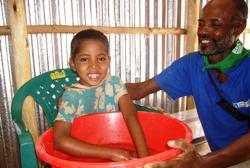 Bei jeder einzelnen der schmerzhaften Behandlungen war der Vater an der Seite seiner kleinen Tochter. Bei jeder Behandlung zeigten sie ihren Lebensmut. Foto: humedica/Christiane Scheffe