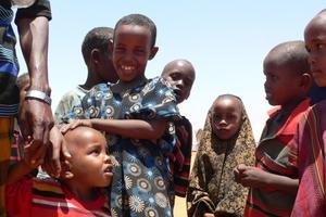 Die meisten der Patienten sind Kinder mit Brandwunden. Foto: humedica