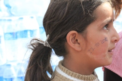 Ihr Onkel schrieb das Datum des alles verändernden Tages auf die Wange des Mädchens. Foto: humedica/Ruth Bücker