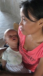 Der kleine Jeremias ist erst drei Monate alt und benötigt dringend eine Operation. Foto: humedica/Margret Müller