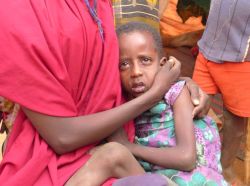 Krankheiten infolge der Unterernährung schwächen die betroffenen Menschen zusätzlich. Medizinische Hilfe ist daher dringend notwendig. Foto: humedica/Judith Kühl