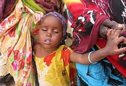 Fatimas Tochter Djamila: Auch bei der Vierjährigen hat die lange Mangelernährung deutlich sichtbare Spuren hinterlassen. Foto: humedica/Judith Kühl