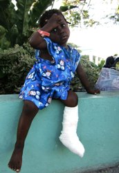 Das gebrochene Bein dieses kleinen Mädchens wird verheilen. Aber dann? Foto: humedica/ Dieter Schmidt