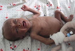 Unterernährt und völlig dehydriert wurde der zwei Monate alte Bengi in die humedica-Klinik nach Drouin gebracht. Foto: humedica/Irmgard Harms