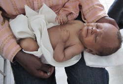 Der kleine Bengi nach nur zwei Tagen in den Händen der humedica-Ärzte. Foto: humedica/Irmgard Harms