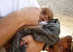 Mit seinen 3200 Gramm Körpergewicht erinnert der zehn Monate alte Fasil eher an einen Neugeborenen. Foto: humedica/Saskia Hankel