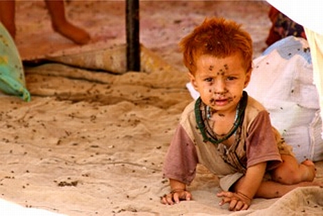 Die Kinder brauchen vor allem unsere Hilfe; mit jedem Tag wird ihre Not größer. Foto: humedica/Judith Kühl