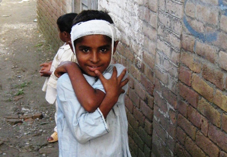 Trotz seiner Kopfverletzung kann dieser kleine Junge wieder zaghaft lächeln. Foto: humedica/Rashid Al Badi