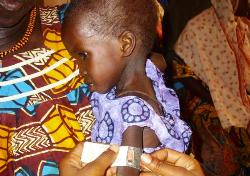 Indbesondere für Kinder, die sich noch in der Entwicklung befinden, hat Mangelernährung schwerste Folgen. Foto: humedica/Simone Winneg