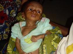 Bei dem kleinen Mahamdou ist jedes zugenommene Gramm überlebenswichtig. Foto: humedica/Simone Winneg