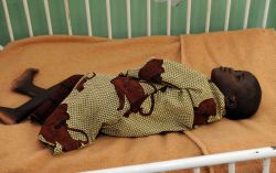 Besonders kleinere Kinder brauchen sofortige medizische Behandlung. Foto: humedica/Großmann