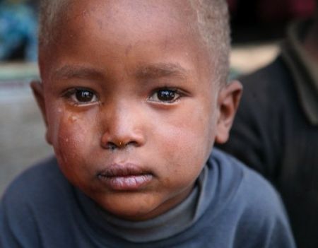 Unzählige Kinder haben die Unruhen der vergangenen Wochen hautnah miterleben müssen und Verletzungen an Körper und Seele erlitten. Foto: David Darg