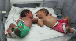 Viele der Kinder kommen mit schweren Erkrankungen. Foto: humedica