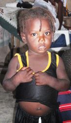 Kinder wie dieses Mädchen sind besonders von den Folgen der Naturkatastrophe betroffen. Foto: humedica