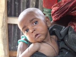 Der kleine Säugling Riday verlor seine Familie und sein Zuhause, leider ist auch sein eigenes Leben noch immer bedroht. Foto: Sandra Schuckmann-Honsel