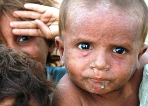 Kinder leiden zusehends unter den schwierigen Bedingungen