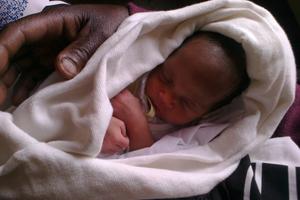 Gerade mal eine Woche auf der Welt, und bereits jetzt muss die kleine Blessing schwerste Herausforderungen bewältigen. Foto: humedica/Sabine Kirchner