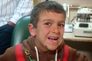 Bashar hat nun allen Grund zur Freude: er ist unter den Hörenden und kann nun unbeschwert wie alle Jungen seines Alters leben. Foto: humedica/Dimitry Bacha