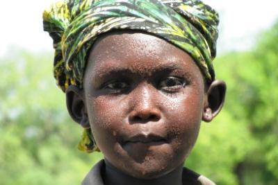 humedica sichert medizinische Versorgung südsudanesischer Flüchtlinge