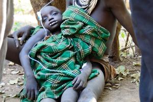 Ein Junge wird nach einer Zahnbehandlung von seiner Mutter getröstet. Foto: humedica