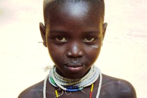 Ein Leben abseits von Moderne und Zivilisation: Der Kara-Stamm in Südäthiopien. Foto:humedica