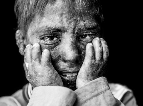 humedica für PR-Bild Award 2017 nominiert