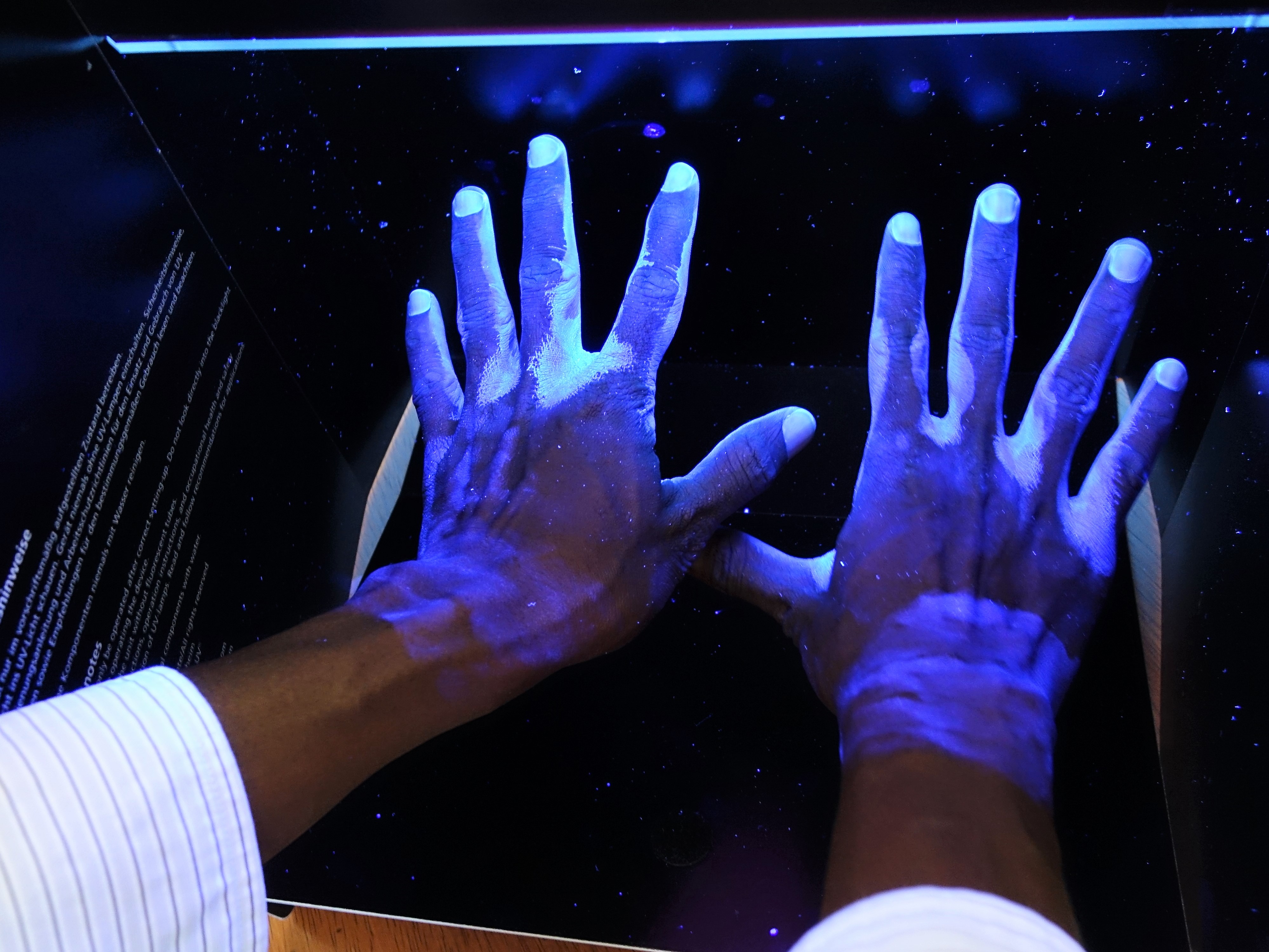 Unter der UV-Lampe werden Krankheitserreger sichtbar. Foto:humedica