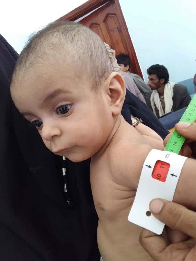 Fast alle Kinder im Jemen sind chronisch unterernährt. Bild: ADRA Jemen.