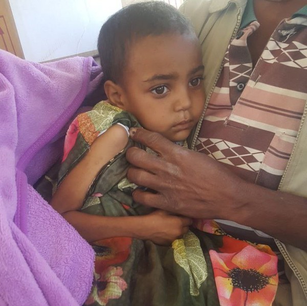 Tigray: Dreiviertel der Bevölkerung vom Hungertod bedroht