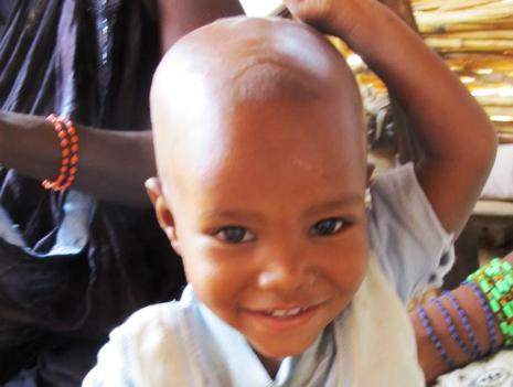 Die kleine Zeinabou im Frühjahr 2011 - ein Gottesgeschenk. Foto: humedica/Simone Winneg